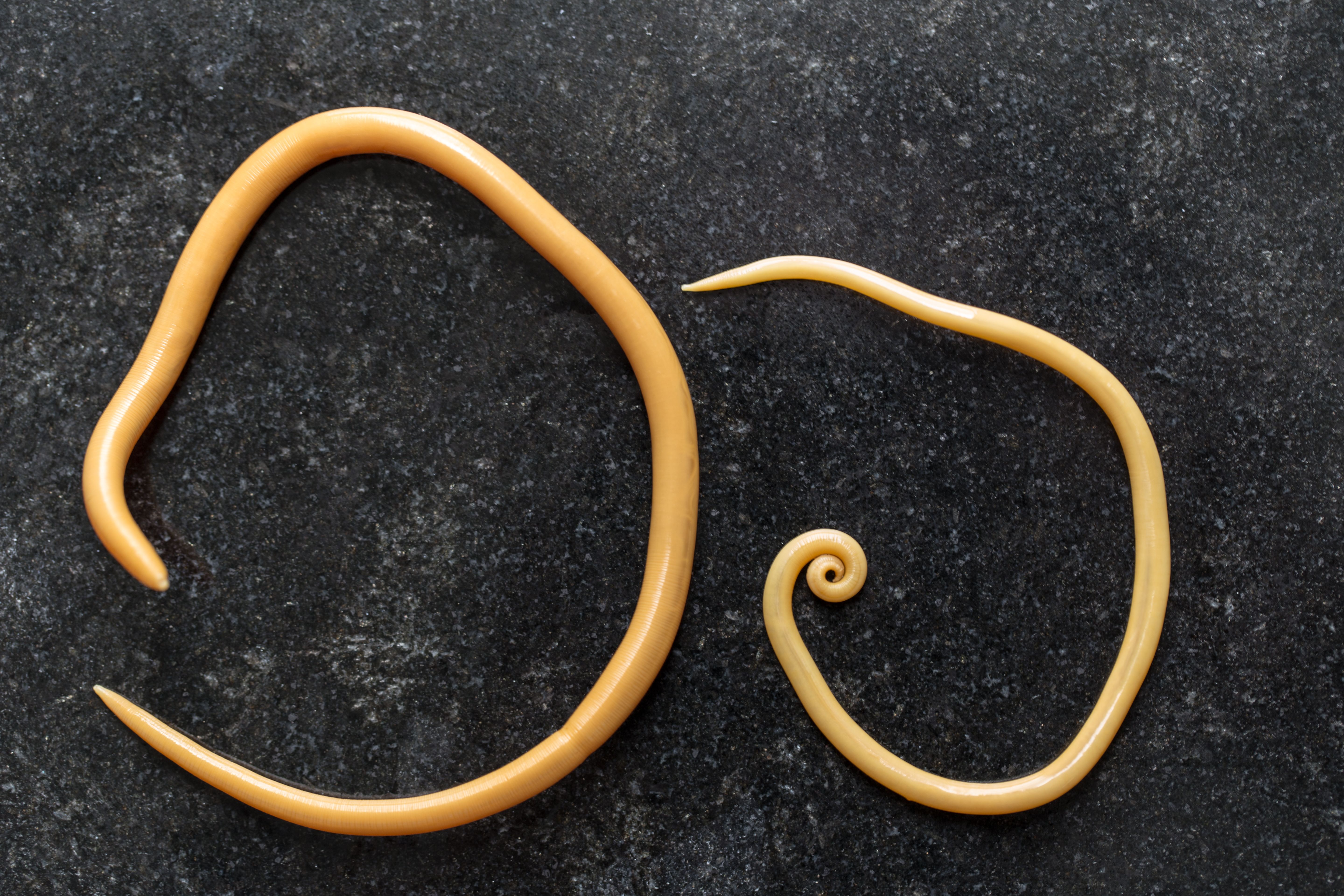 10 Most Terrifying Parasites That Can Infect Humans