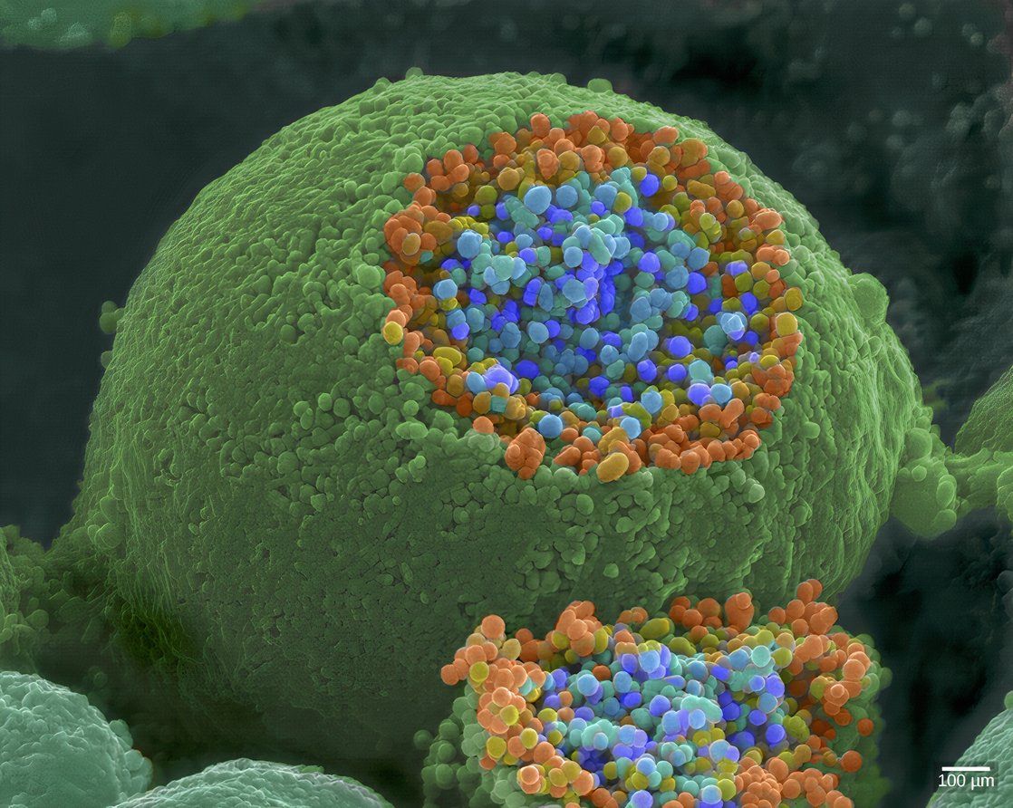 A Recently Discovered Organism Survives Without This Crucial 