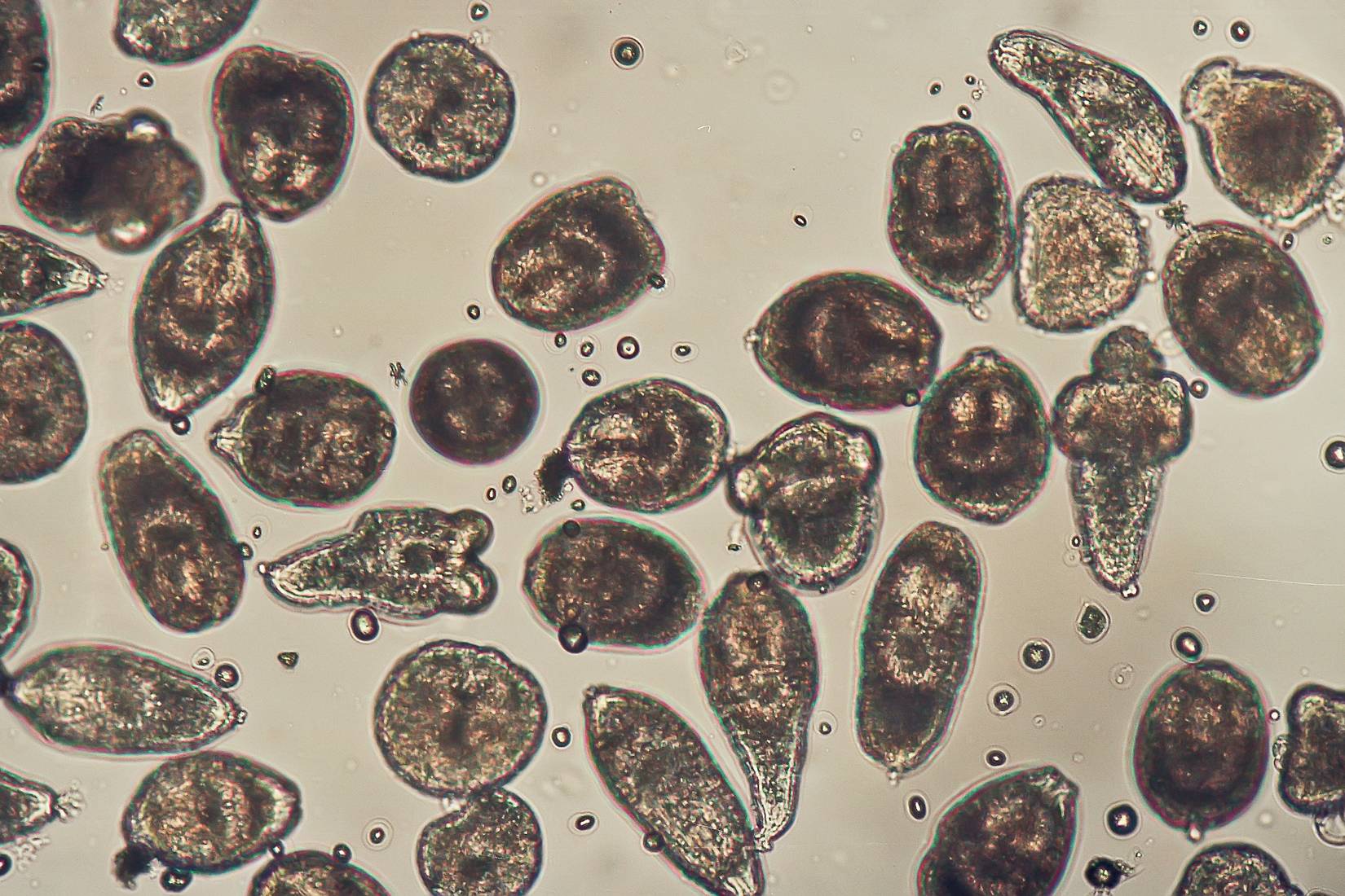 Scientists Just Found A Dangerous Parasite Hiding In The Pacific Northwest